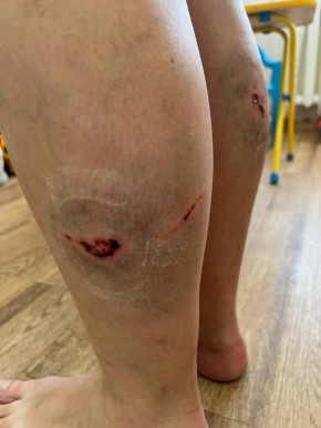 �������������, ��� ������ ������� ����, ��� ����� ����� �� ����: � ����� ��������� ������ ������ �� ������� � ��������