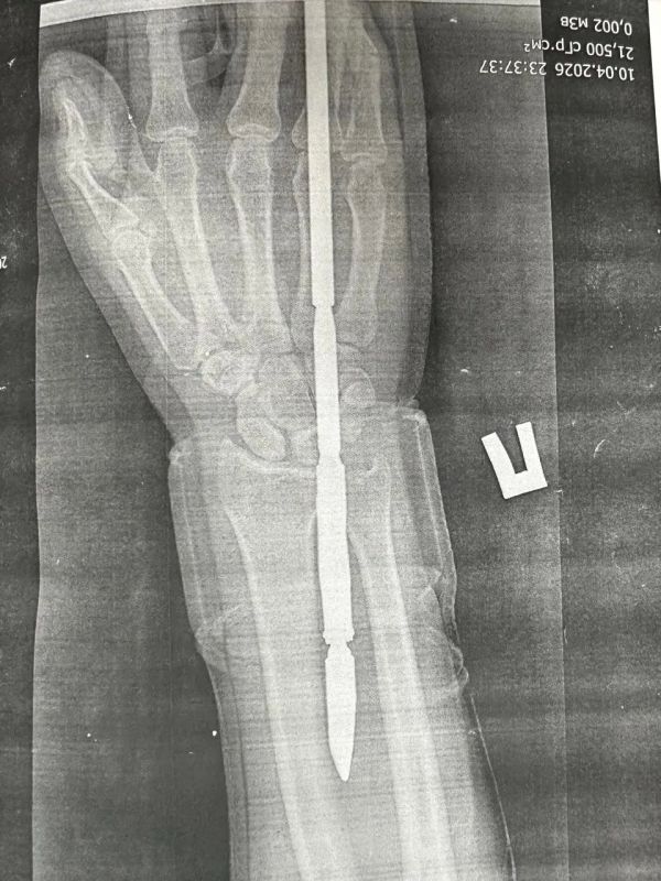 ������ ����� �������� ��������� � ���� �� ���������� �����