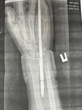 ������ ����� �������� ��������� � ���� �� ���������� �����