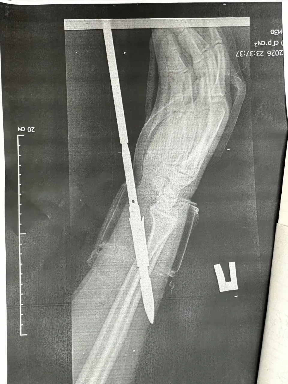 Орский рыбак случайно выстрелил в себя из подводного ружья Орский рыбак случайно выстрелил в себя из подводного ружья