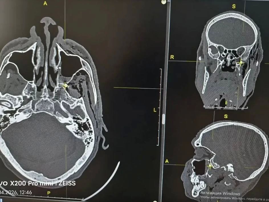 ���� �� ������ ������� �������� ������� � �������� �����