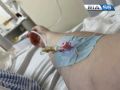 Советы эксперта: как оренбуржцам не испортить отдых «болезнью грязных рук»?