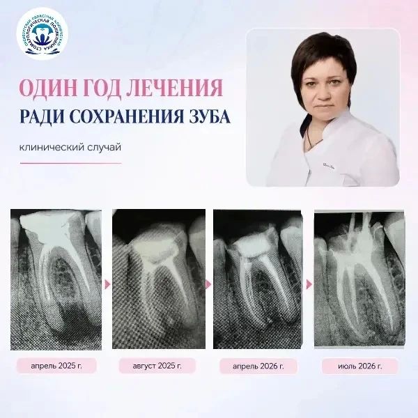 ОДИН ГОД ЛЕЧЕНИЯ РАДИ СОХРАНЕНИЯ ЗУБА